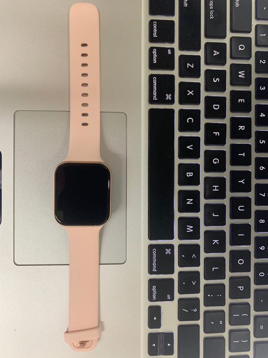 OPPOwatch41mm成色99新