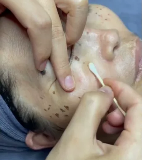 斑到底给你的生活带来了怎么样的影响❓❓ ①...